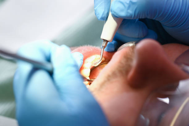 Best Broken or Chipped Tooth Repair in , WV