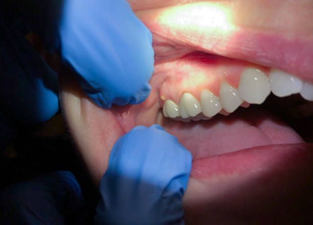 Best Broken or Chipped Tooth Repair in , WV